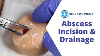 abscess incision drainage fnp perioperative